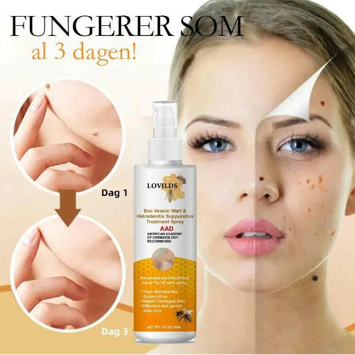 Dmart Online Bee Venom Wart Remover Spray